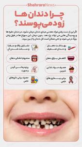  اینفوگرافی| چرا دندان‌ها زود می‌پوسند؟