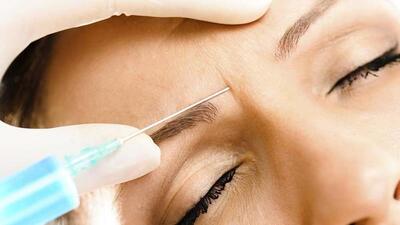  بازار داغ «زیبایی» زیر تیغ سودجویان؛ هشدار نظام پزشکی به رشد قارچ‌گونه مراکز غیرمجاز