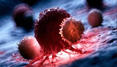  «کشف توده» یا «غربالگری»؟ نقد سیاست‌های تشخیص سرطان در کشور