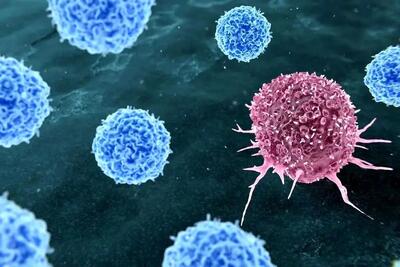  این دو عادت متهمان ردیف اول ابتلا به سرطان هستند | هشدار جدی برای سلامتی بدن