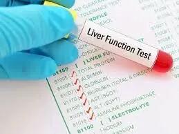  برای تشخیص کبد چرب آزمایش بهتر است یا سونوگرافی؟