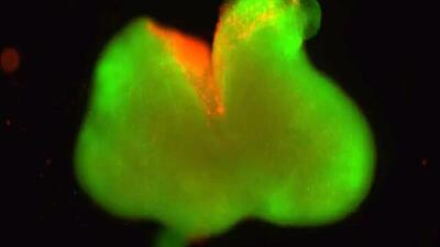  دستاوردی قابل توجه در ترمیم نخاع