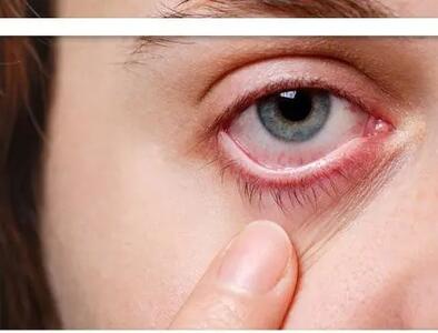  باکتری پنهان در چشم، احتمالاً محرک بیماری آلزایمر است