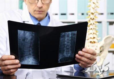  ۵ روش عالی برای داشتن استخوان‌های محکم و سالم - مجله اینترنتی کولاک