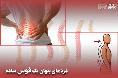  پادکست | دردهای پنهان یک قوس ساده