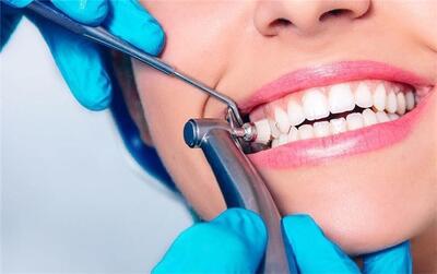  بررسی مارک های خمیر پروفیلاکسی دندانپزشکی