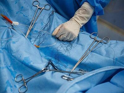  برخی افراد جان خود را برای عمل‌های زیبایی کاملا غیرضروری به خطر می‌اندازند/ نقش بلاگر‌های فضای مجازی در تبلیغات فریبنده + فیلم