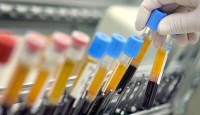  محرومیت ۲ ورزشکار دوپینگی