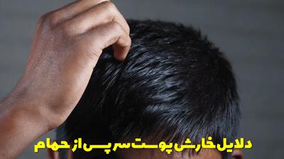  دلایل خارش پوست سر پس از حمام و بهترین روش های درمان آن