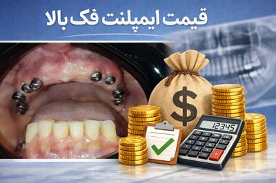  قیمت ایمپلنت فک بالا
