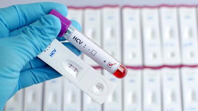  آیا ایدز (HIV ) از آغوش، بوسیدن و از سرفه یا عطسه منتقل می شود؟