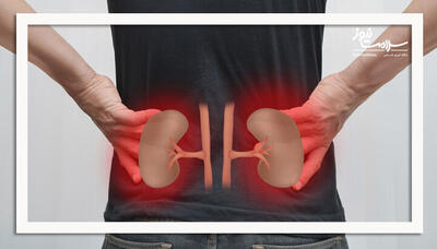  کلید پیشگیری از بیماری مزمن کلیه