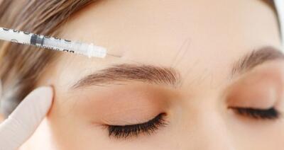  نقاط تزریق بوتاکس برای لیفت ابرو و اصول ایمن انجام آن