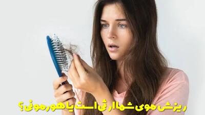  ریزش موی شما ارثی است یا هورمونی؟ راه های نحوه تشخیص و نکات آن