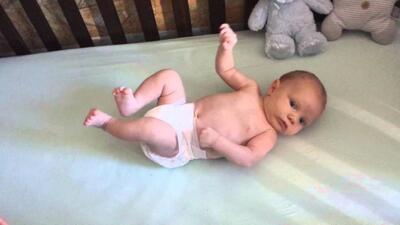  رفلکس مورو در نوزادان؛ چرا بررسی آن بعد از تولد اهمیت دارد؟