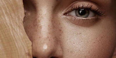  چرا داشتن کک و مک ناگهان انقدر محبوب شد؟ هرآنچه لازم است درباره کک و مک بدانید - چی بپوشم