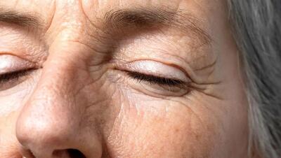  چگونه ظهور چین و چروک‌های صورت را به تأخیر بیندازیم؟