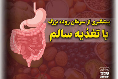  پادکست | پیشگیری از سرطان روده بزرگ با تغذیه سالم