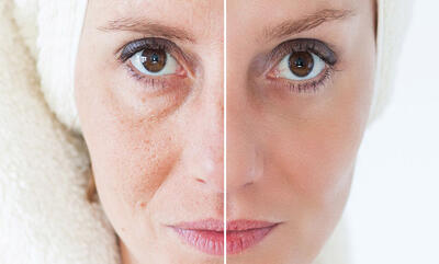  جدیدترین روش‌های جوانسازی صورت در 2026 - پارس فوتبال