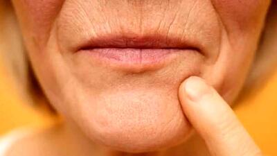  دلایل نازک تر شدن لب ها در دوران پیری