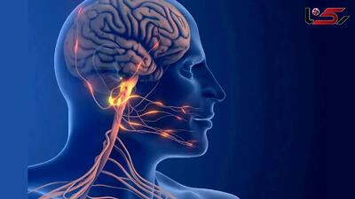  میگرن از چه مسیر جدیدی به مغز حمله می‌کند؟