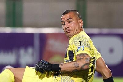  حامد لک: شبیه اسکار فیس شده‌ام!