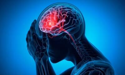  علائم هشدار سکته مغزی در ۹۰ روز آینده