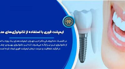  بهترین دندانپزشکی و دکتر ایمپلنت فوری و دیجیتال - مردم سالاری آنلاین