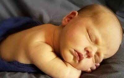  زردی نوزاد؛ خطرات زردی، علائم، درمان و روش های پیشگیری