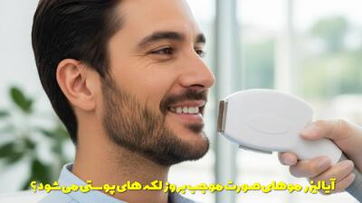  آیا لیزر موهای صورت موجب بروز لکه‌ های پوستی می‌ شود؟ از شایعه تا واقعیت