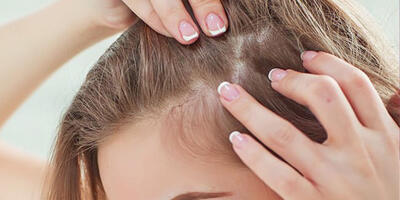  ماینوکسیدیل چیست و چگونه در درمان ریزش مو، معجره می‌کند؟ - چی بپوشم