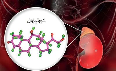  علائم کورتیزول بالا یا پایین