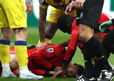  تصاویر تکان‌دهنده از فک خرد شده ستاره میلان