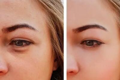  آیا روزه داری پف صورت را از بین می برد؟