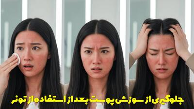  جلوگیری از سوزش پوست بعد از استفاده از تونر + بررسی علت آن