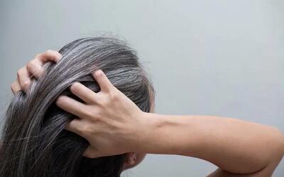  سفید شدن مو در دهه‌ی بیست زندگی؟ شاید پای کمبودهای تغذیه‌ای در میان باشد