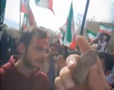  روایت دانشجوی مجروح از ایستادگی در برابر فتنه‌گری و اغتشاش
