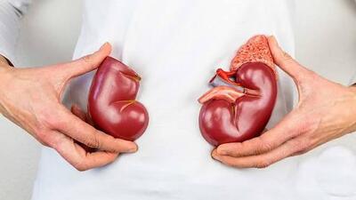  آیا بیماران کلیوی میتوانند روزه بگیرند؟!