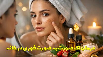  درمان لک صورت به صورت فوری در خانه با چند روغن گیاهی و طبیعی