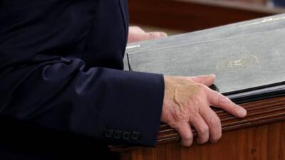  دست گریم شده ترامپ در کنگره آمریکا