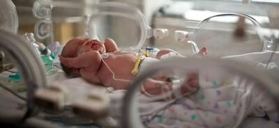  کاهش مرگ‌ومیر نوزادان با تقویت NICU در بیمارستان امام سجاد یاسوج