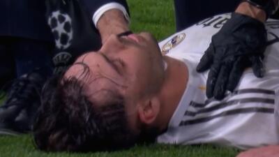  خودزنی رئالی‌ها که باعث مصدومیت شدید آسنسیو شد!