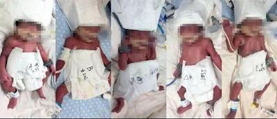  مادر جوان 5قلو به دنیا آورد