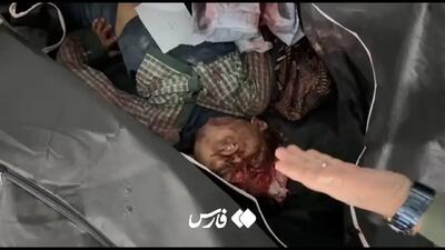  تصاویری از پیکر شهدای حملۀ جنایتکارانۀ آمریکا و رژیم صهیونیستی به میناب/ حاوی تصاویر بسیار دلخراش