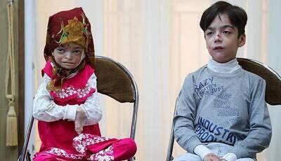  تخمین وجود ۳میلیون «بیمار نادر» در ایران