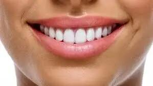  فرق لمینت و کامپوزیت دندان
