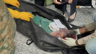  تصاویر جدید از قربانیان حمله آمریکا به مدرسه میناب