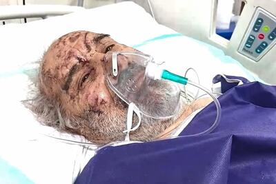  بیمارستان ۷ تیر شهرری؛ مداوای مجروحان جنگ در جنوب تهران