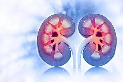  عوامل اصلی سنگ کلیه را بشناسید