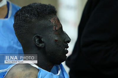  اقدامات اولیه برای کاهش آسیب سوختگی در شرایط بحران